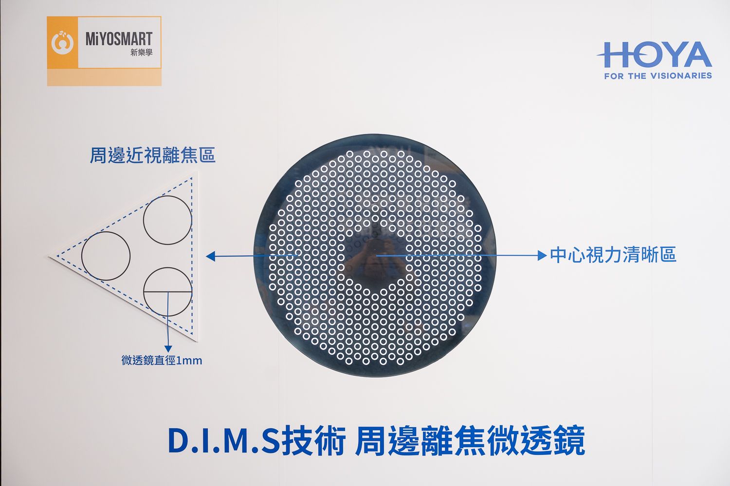 HOYA新樂學鏡片透過獨家的D.I.M.S.技術，鏡片中央提供清晰視力，同時透過周邊減緩眼軸增長，孩子白天正常配戴即可達到近視延緩效果。.jpg