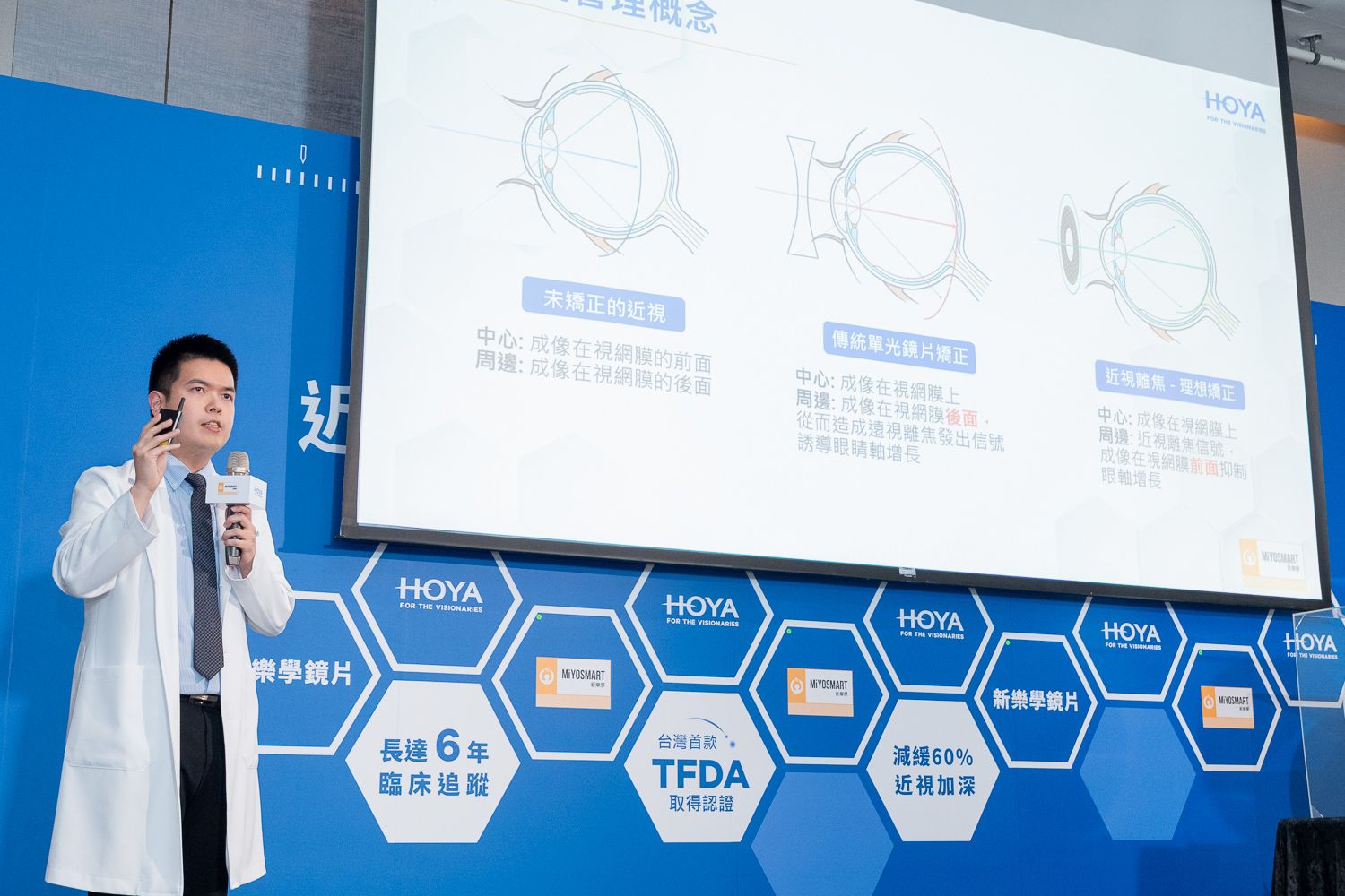 青埔諾貝爾眼科 院長簡乾証以「近視危機」為分享主題，同時以「氣球膨脹」的比喻說明高度近視風險，隨著度數增加，眼軸會不斷拉長，眼球壁會變薄。.jpg